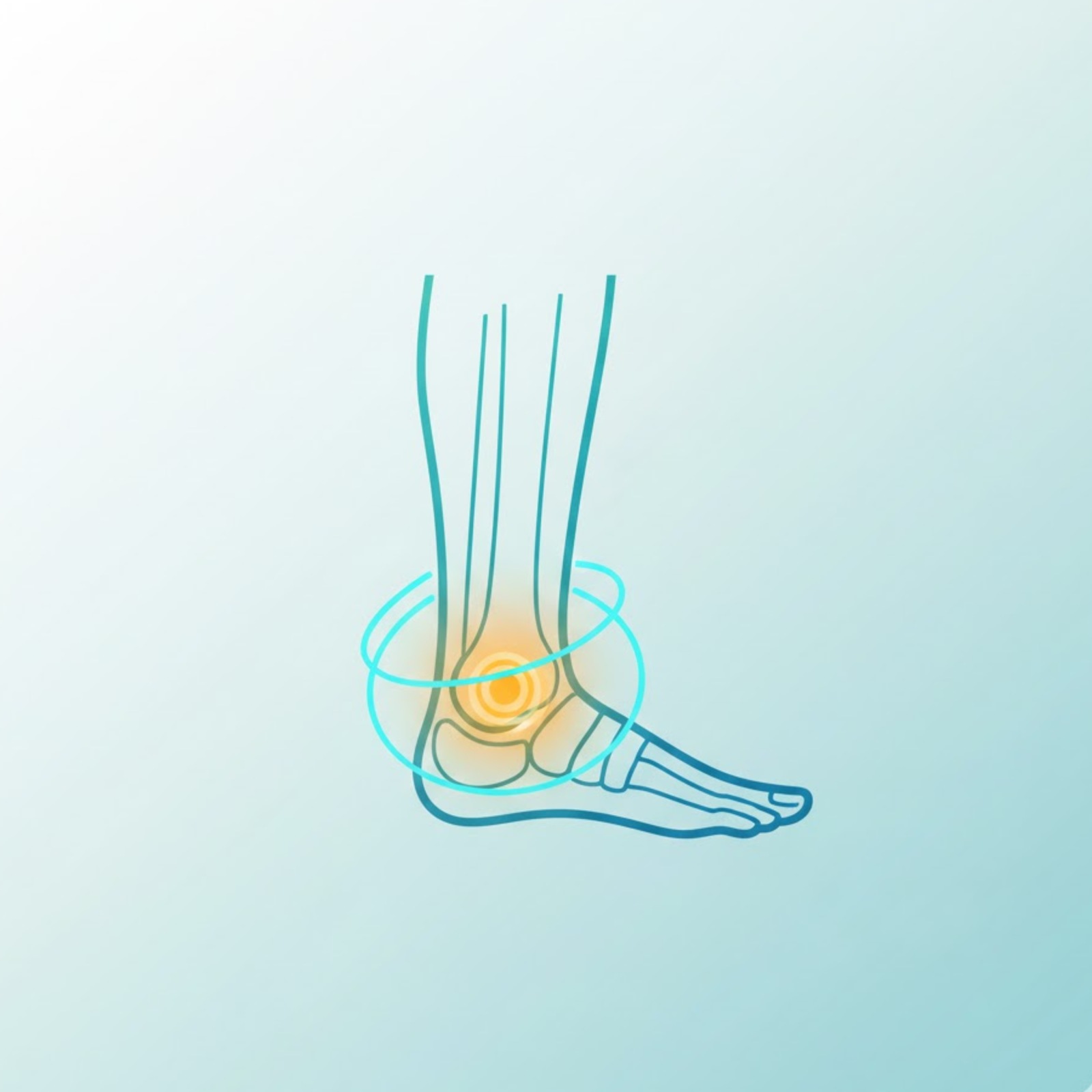 Illustration entorse de la cheville