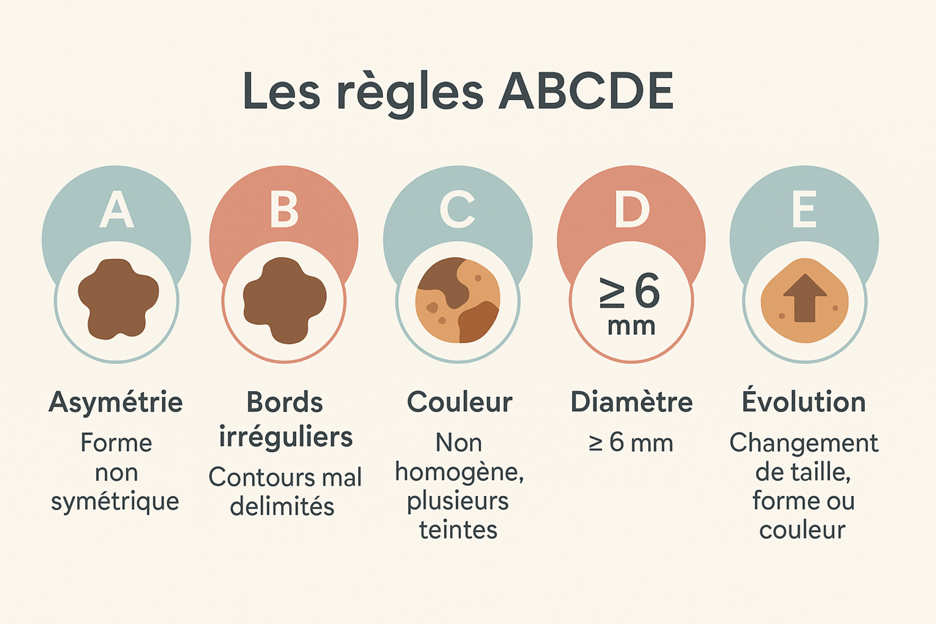 Comment détecte-t-on un cancer de la peau ? La « règle ABCDE »