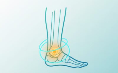 Entorse de la cheville et ostéopathie.